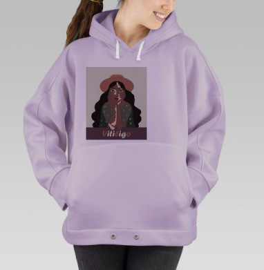 Спокойное принятие витилиго девушка и ягодный цвет, Hoodie Oversize Fiolet